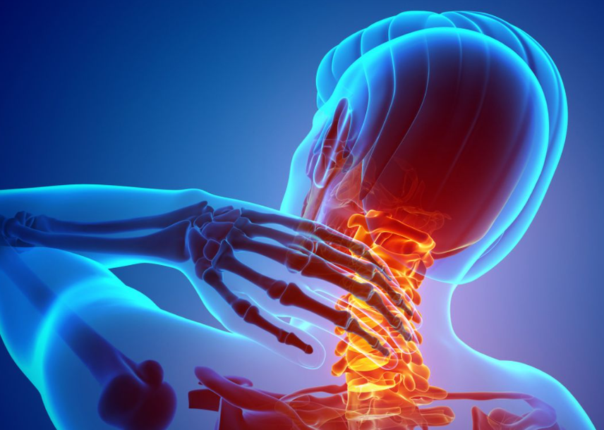 Otot Leher Tegang, Kenali Penyebab dan Cara Mencegahnya